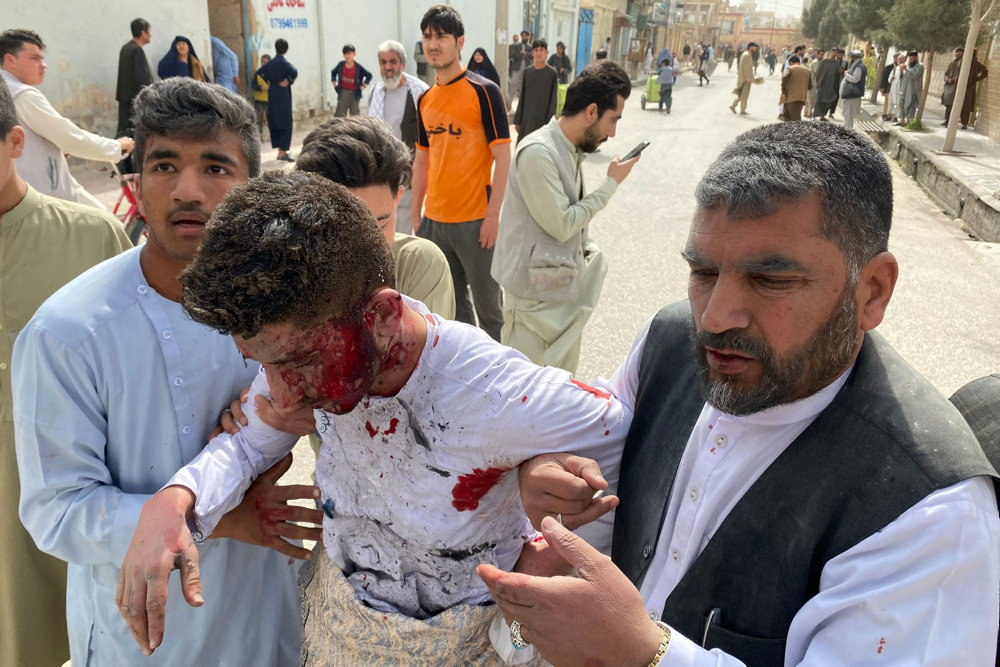 AFGHANISTAN-MEDIA-BLAST